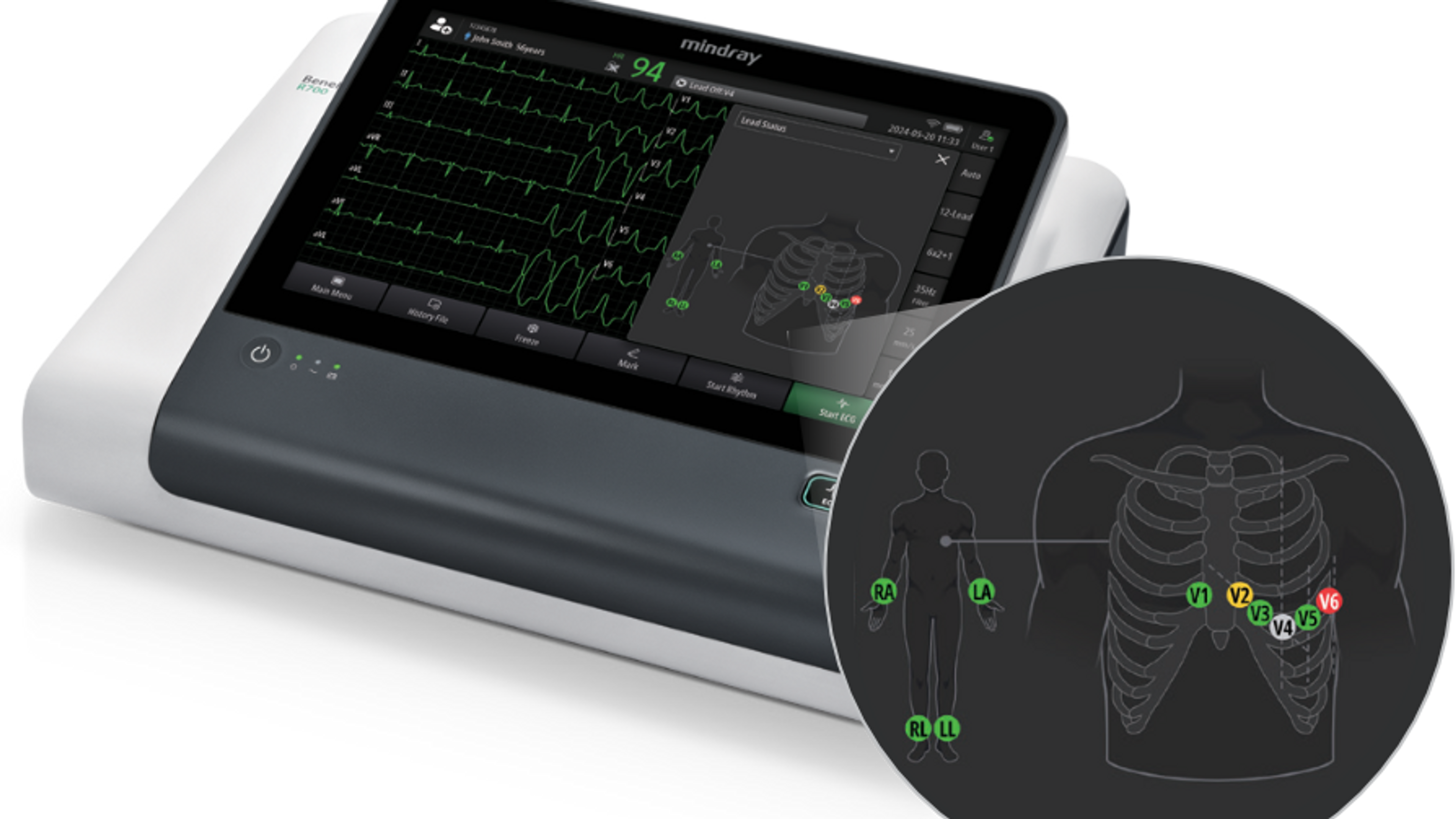 Mindray BeneHeart R700 ECG Education